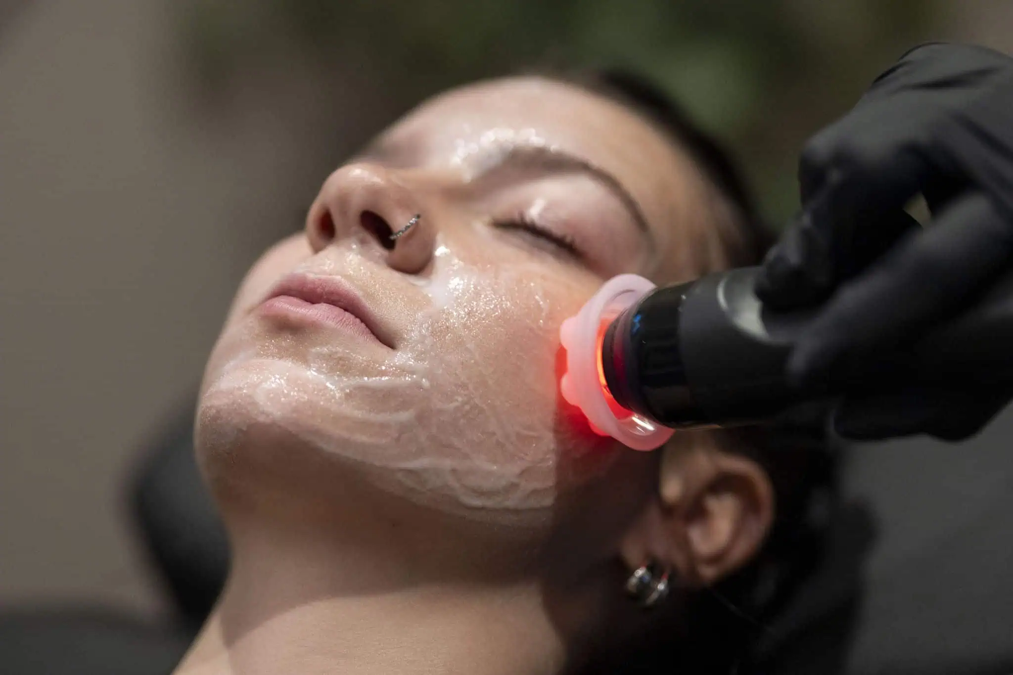 Facial Treatments | Culture Aesthetics and Wellness | Knoxville, TN