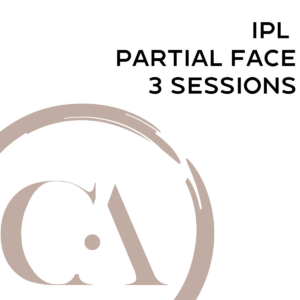 IPL-partials-face-3-Sessions | Culture Aesthetics and Wellness | Knoxville, TN