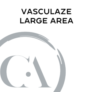 Vasculaze-Large-Area | Culture Aesthetics and Wellness | Knoxville, TN