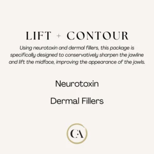 Lift and Contour