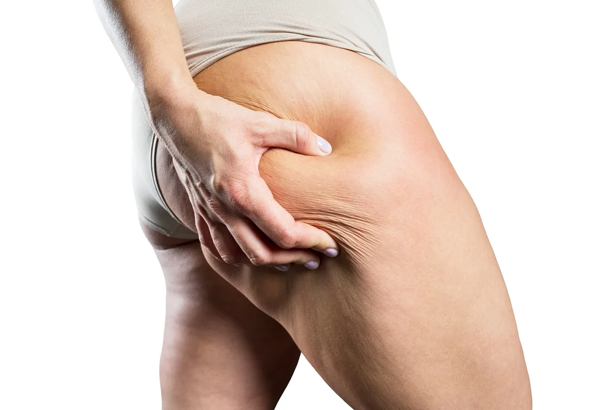 Body contouring to reduce thigh fat and improve skin laxity