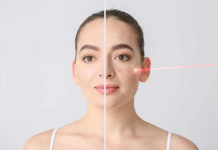 Pigmentation and Redness Treatment – Culture Aesthetics & Wellness -TN